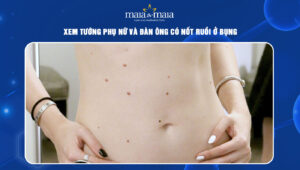 nốt ruồi ở bụng