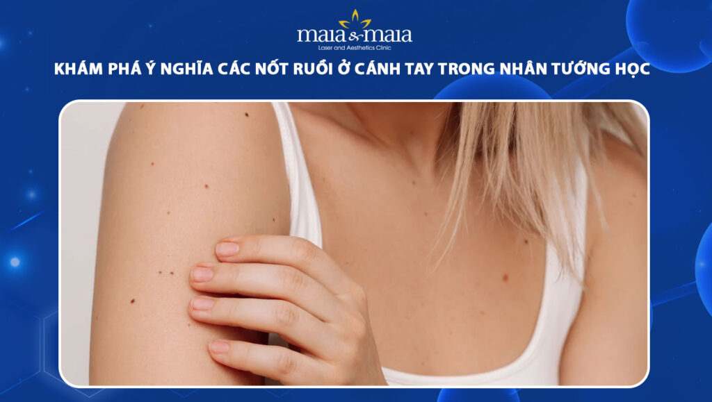 nốt ruồi ở cánh tay