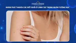 nốt ruồi ở cánh tay