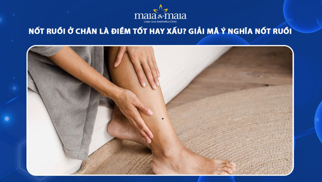 Nốt ruồi ở chân là điềm tốt hay xấu? Giải mã ý nghĩa cụ thể 1 nốt ruồi ở chân