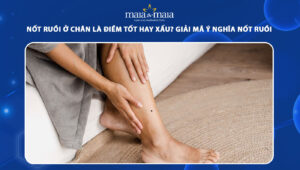 nốt ruồi ở chân