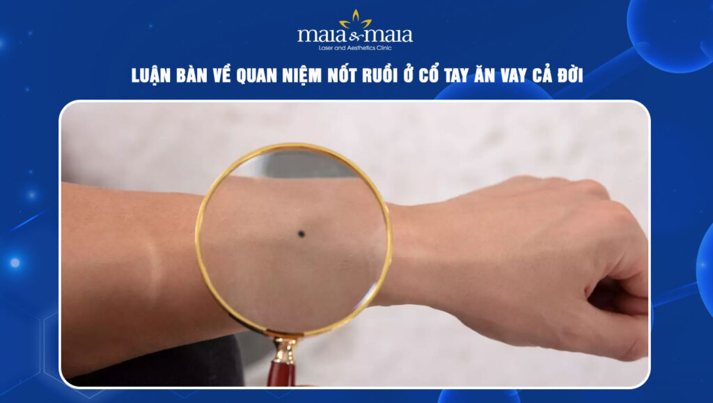 Nốt ruồi ở cổ tay ăn vay cả đời