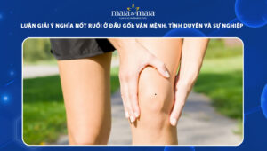 nốt ruồi ở đầu gối