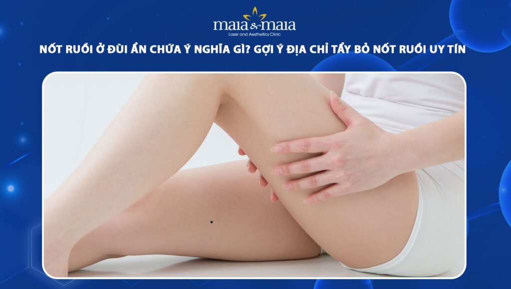 Nốt ruồi ở đùi ẩn chứa ý nghĩa gì? Gợi ý địa chỉ tẩy bỏ nốt ruồi uy tín hiện nay 1 nốt ruồi ở đùi