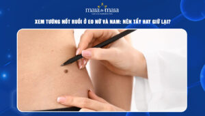 nốt ruồi ở eo