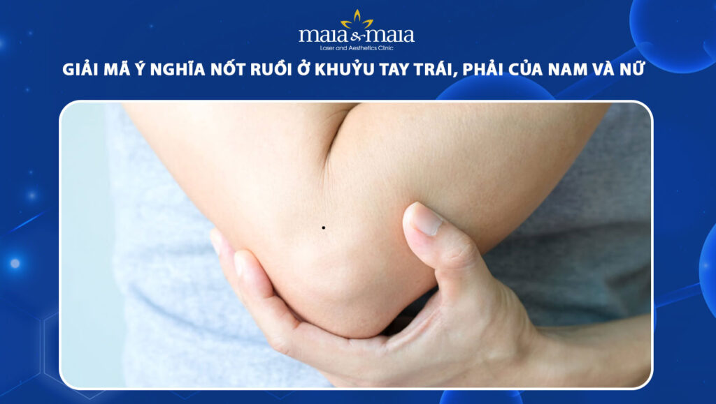 Giải mã ý nghĩa nốt ruồi ở khuỷu tay của nam và nữ giới 1 nốt ruồi ở khuỷu tay