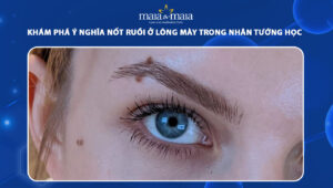 nốt ruồi ở lông mày