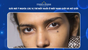 nốt ruồi ở mắt