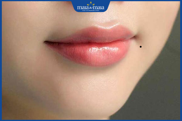 nốt ruồi ở mép miệng trái