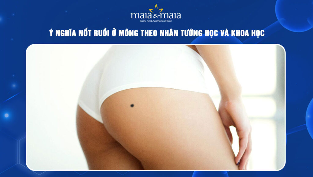 Ý nghĩa nốt ruồi ở mông theo nhân tướng học và khoa học 1 Nốt ruồi ở mông