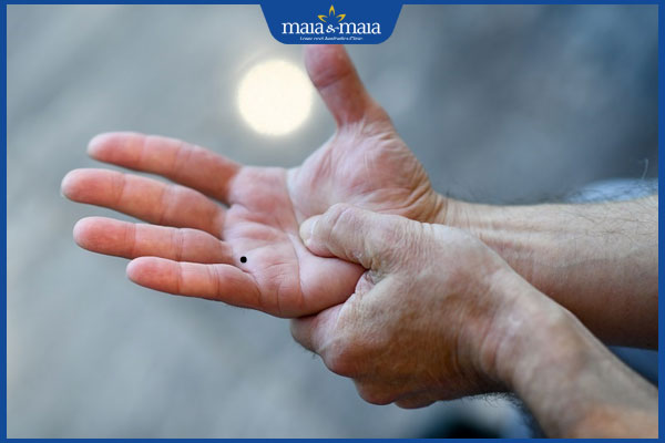 Nốt ruồi ở kẽ ngón tay tiềm ẩn ý nghĩa gì? Có nên tẩy không? 3 nốt ruồi ở ngón út và áp út