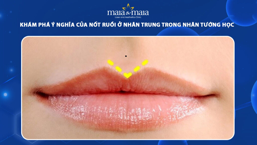 nốt ruồi ở nhân trung