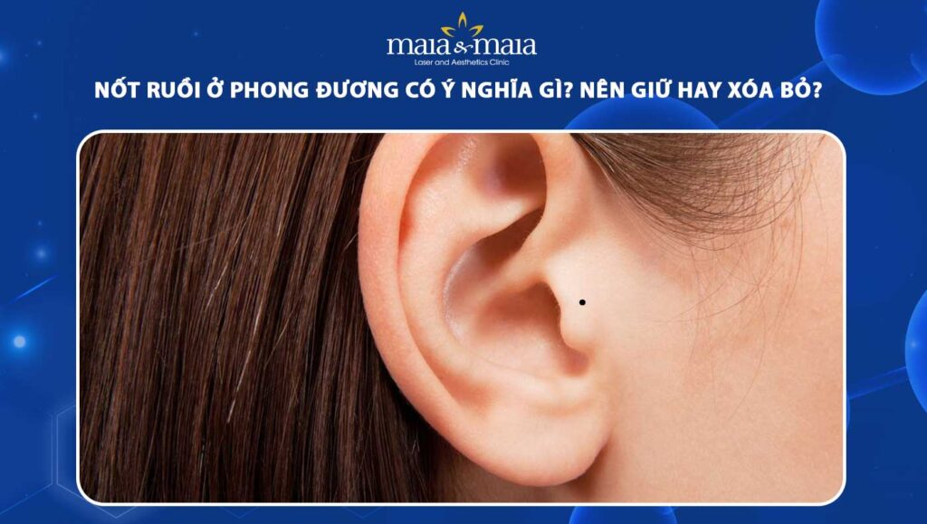 nốt ruồi ở phong đương