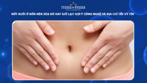 nốt ruồi ở rốn