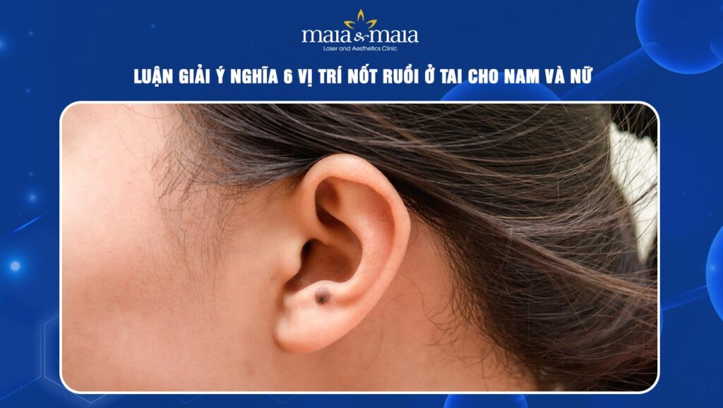 Luận giải ý nghĩa 6 vị trí nốt ruồi ở tai cho nam và nữ giới 1 Nốt ruồi ở tai