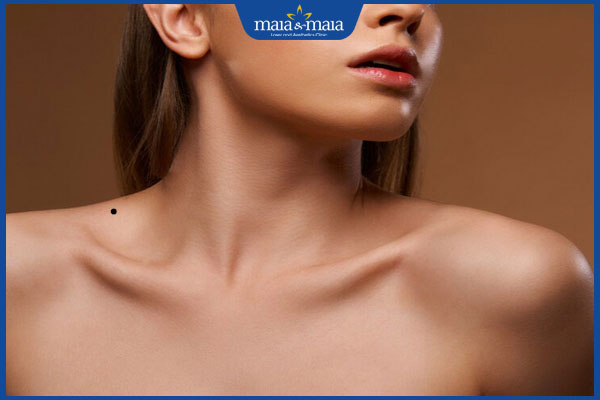 Ý nghĩa các vị trí nốt ruồi ở vai trong nhân tướng học 4 nốt ruồi ở vai gần cổ