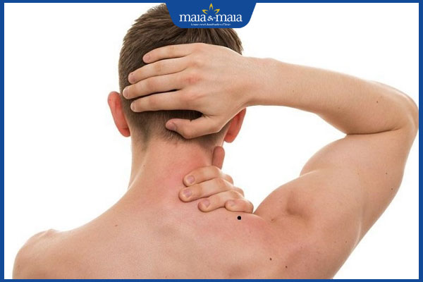 Ý nghĩa các vị trí nốt ruồi ở vai trong nhân tướng học 3 nốt ruồi ở vai nam giới