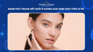 nốt ruồi ở xương quai hàm