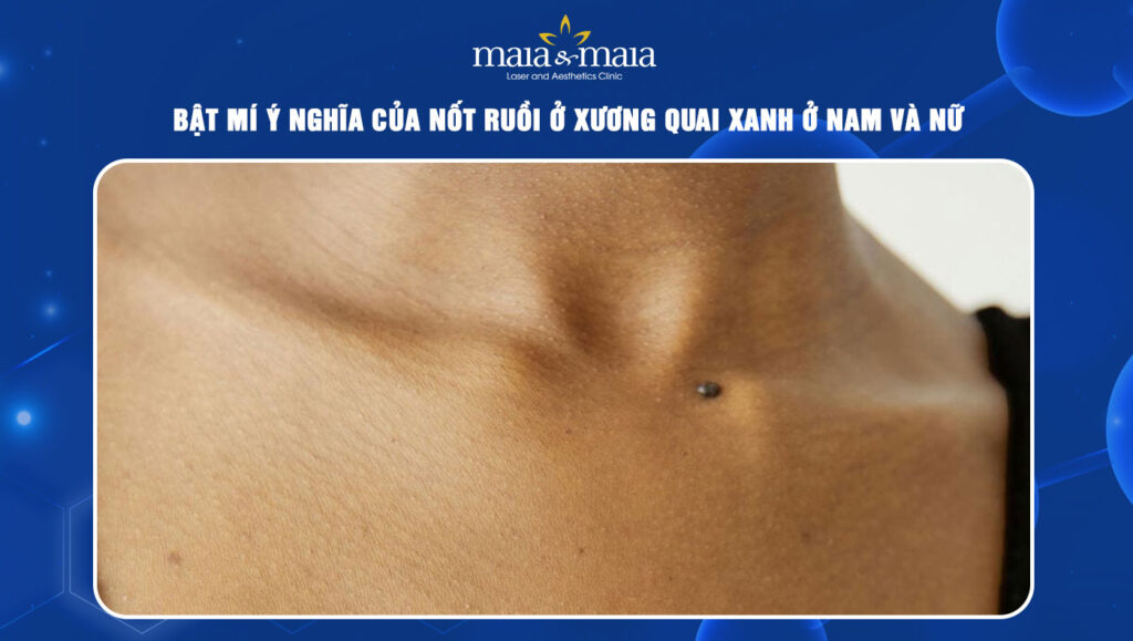 nốt ruồi ở xương quai xanh