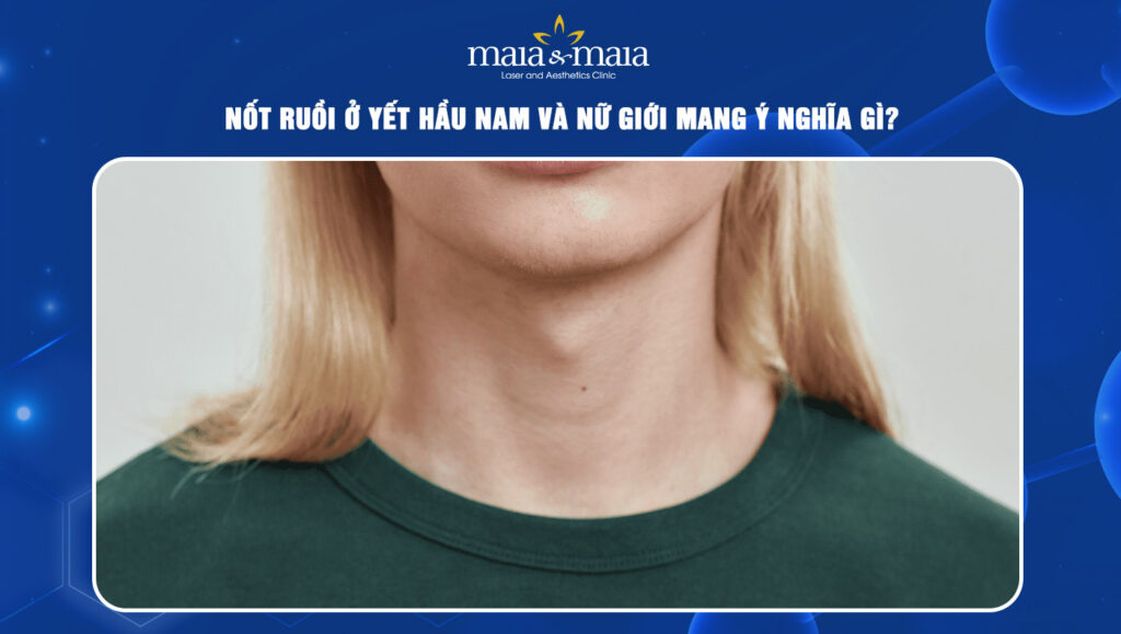 nốt ruồi ở yết hầu