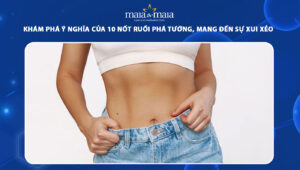 nốt ruồi phá tướng
