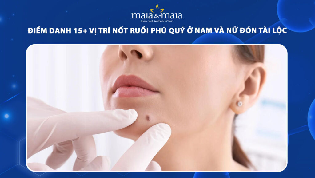 nốt ruồi phú quý