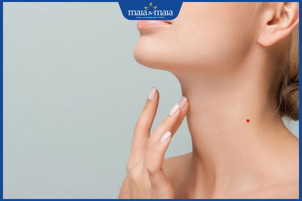 nốt ruồi phú quý ở cổ