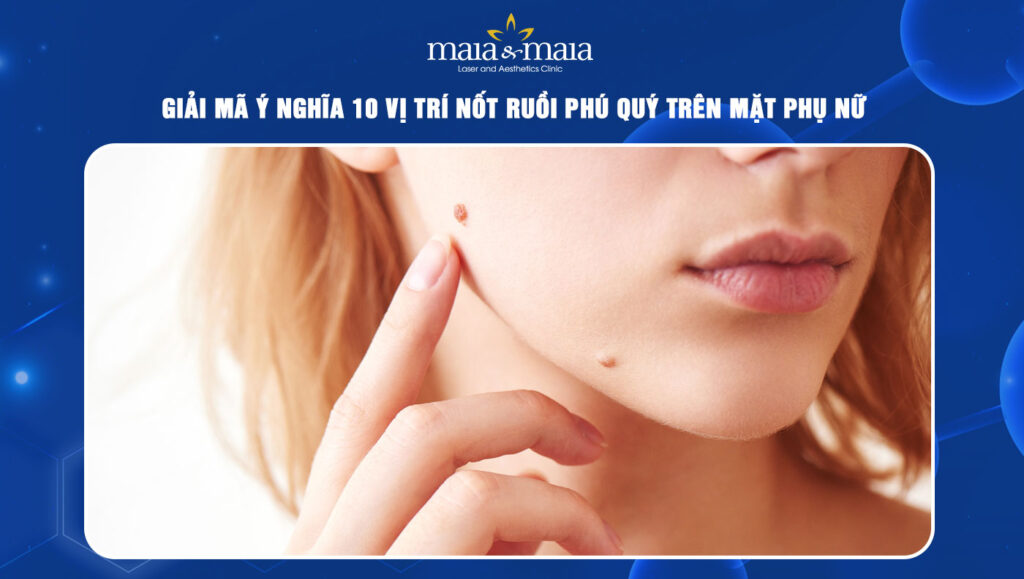 nốt ruồi phú quý trên mặt phụ nữ