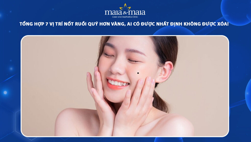 nốt ruồi quý hơn vàng
