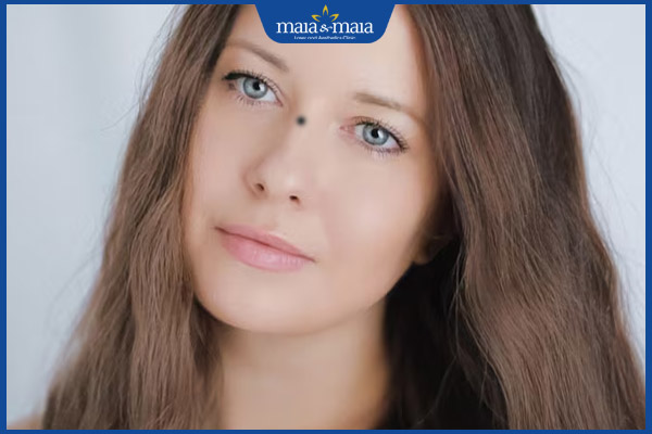 nốt ruồi sơn căn nữ