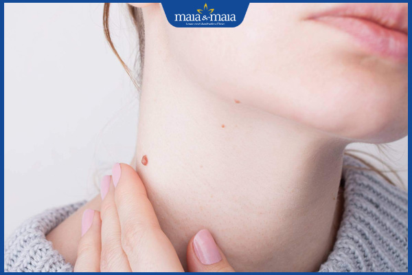 Nốt ruồi son ở cổ có ý nghĩa gì? Đây là tốt hay xấu? 3 nốt ruồi son cổ nữ