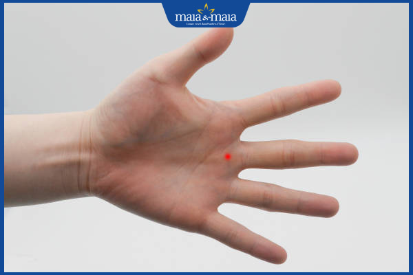 nốt ruồi son ngón giữa