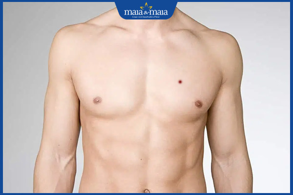 Nốt ruồi son ở ngực nói lên điều gì đối với cả nam và nữ? 3 nốt ruồi son ngực nam