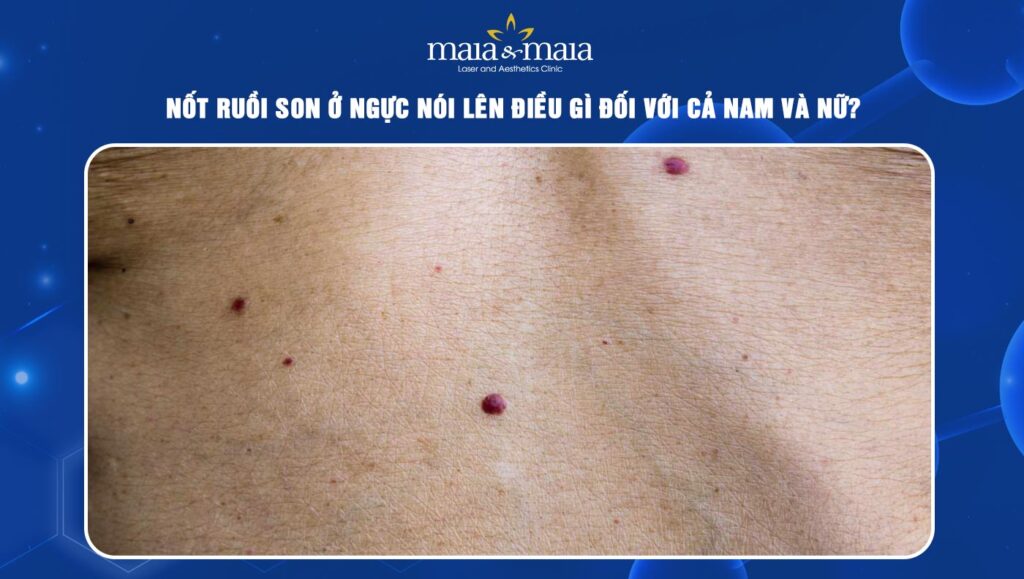 Nốt ruồi son ở ngực nói lên điều gì đối với cả nam và nữ? 1 Nốt ruồi son ở ngực