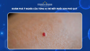 nốt ruồi son phú quý