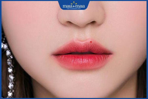 nốt ruồi son phú quý ở môi