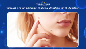 nốt ruồi tài lộc