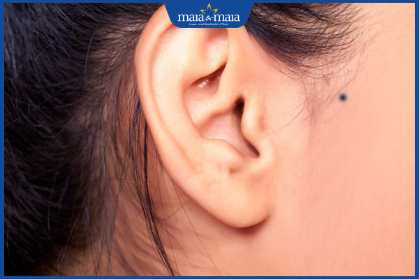 nốt ruồi tóc mai nữ