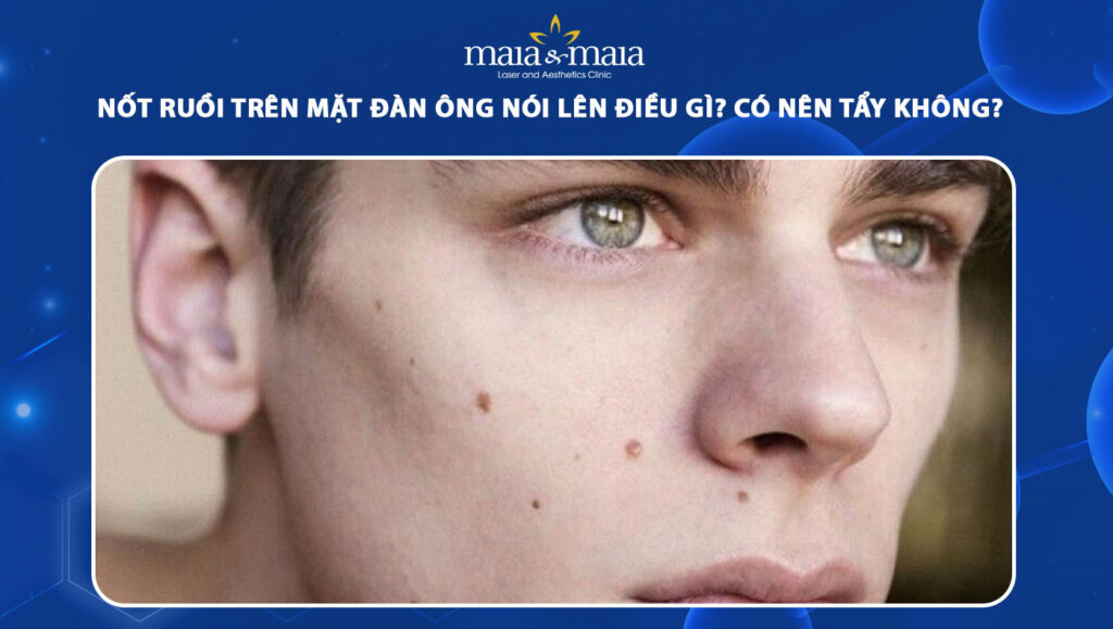nốt ruồi trên mặt đàn ông