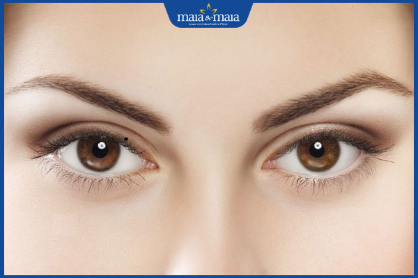 nốt ruồi trên mí mắt