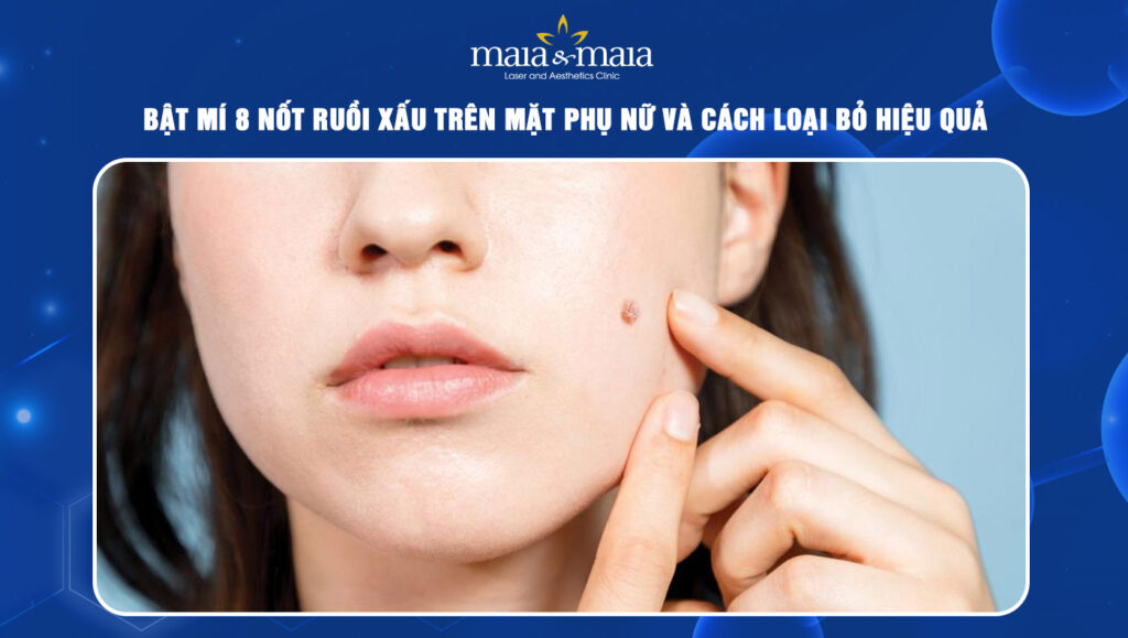 8 nốt ruồi xấu trên mặt phụ nữ và cách loại bỏ hiệu quả 1 nốt ruồi xấu trên mặt phụ nữ