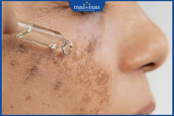 Tế bào gốc trị mụn như thế nào? Đánh giá ưu nhược điểm 4 sản phẩm chứa tế bào gốc