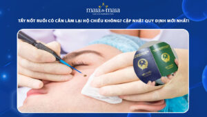 tẩy nốt ruồi có cần làm lại hộ chiếu không