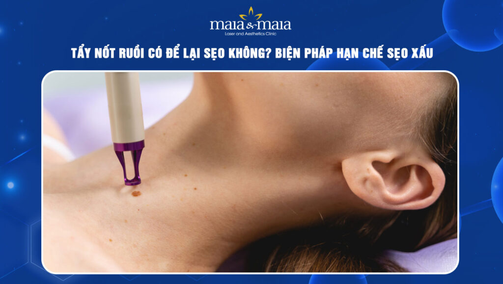 tẩy nốt ruồi có để lại sẹo không