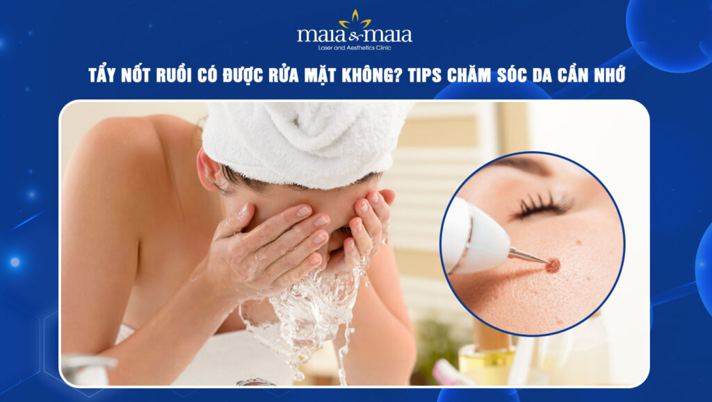 Tẩy nốt ruồi có được rửa mặt không? Tips chăm sóc cần nhớ 1 tẩy nốt ruồi có được rửa mặt không