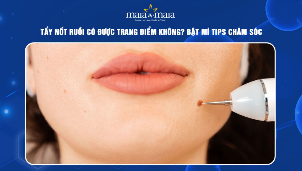 tẩy nốt ruồi có được trang điểm không