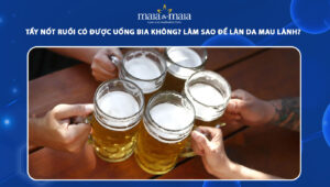 tẩy nốt ruồi có được uống bia không