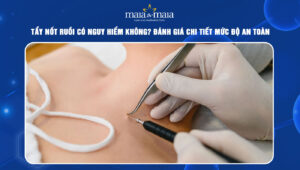 tẩy nốt ruồi có nguy hiểm không