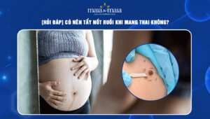 tẩy nốt ruồi khi mang thai