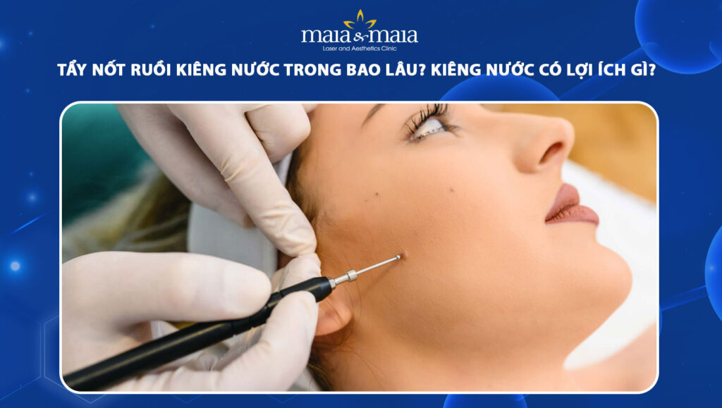 Tẩy nốt ruồi kiêng nước trong bao lâu? Lý do cần kiêng? 1 tẩy nốt ruồi kiêng nước trong bao lâu